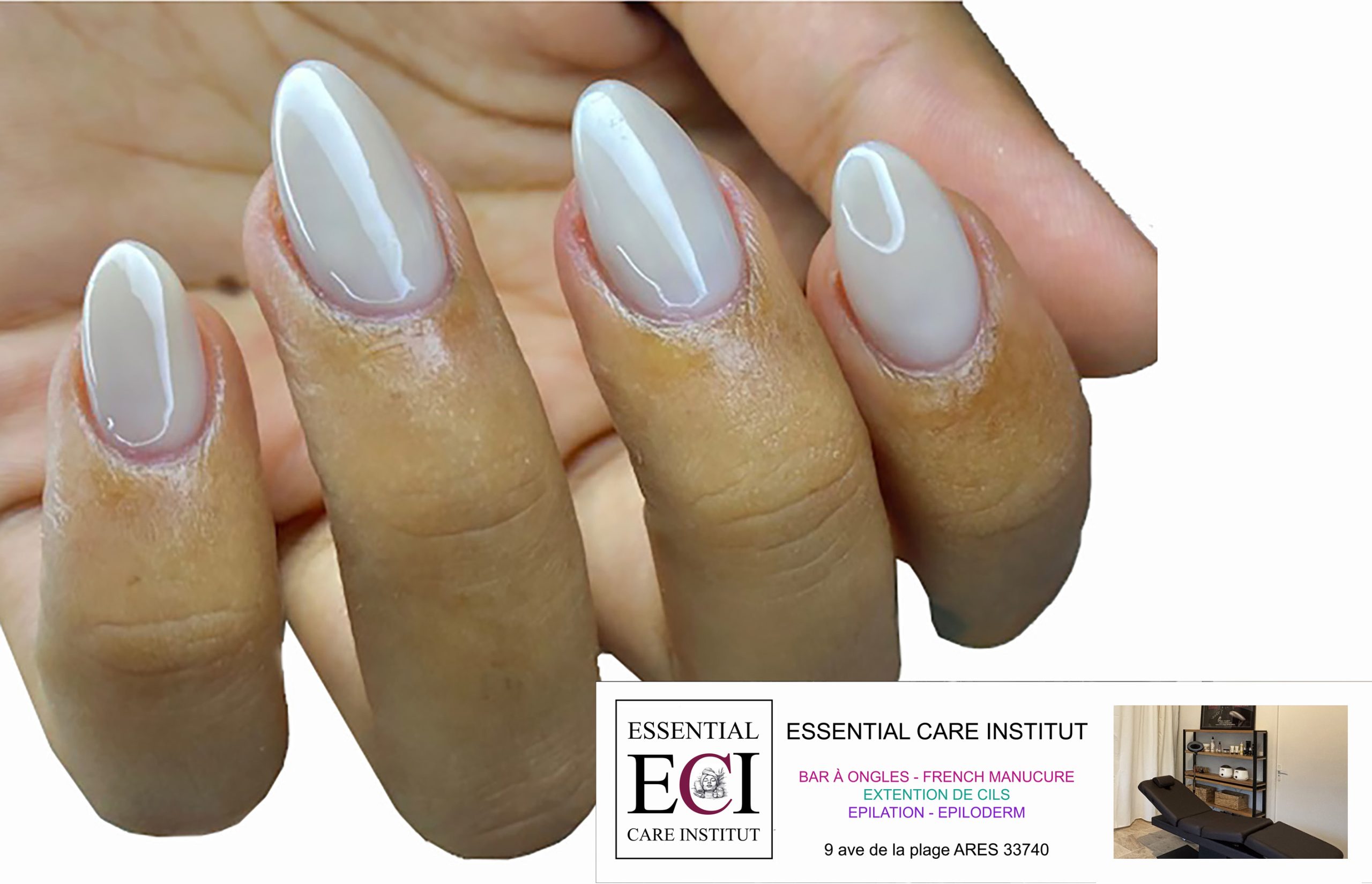 Ongles Mérignac